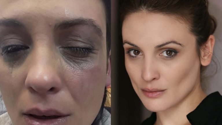 Криминален психолог попиля битата актриса Диана Димитрова и категорично я обвини в лъжа
