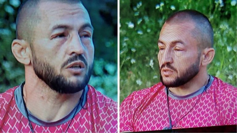Мачото Гатьо проплака от тежък проблем в “Игри на волята”, лицето му се поду след… СНИМКИ