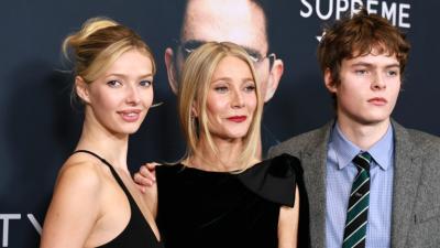 Козметичната процедура, за която Епъл Мартин съжалява